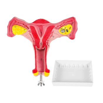 Модел дамски матката на човека 1:1, яйчниците, Маточните тръби, Анатомическая модел анатомия на човека, учебни помагала
